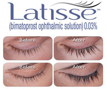 Load image into Gallery viewer, Latisse® Eyelash Enhancement
